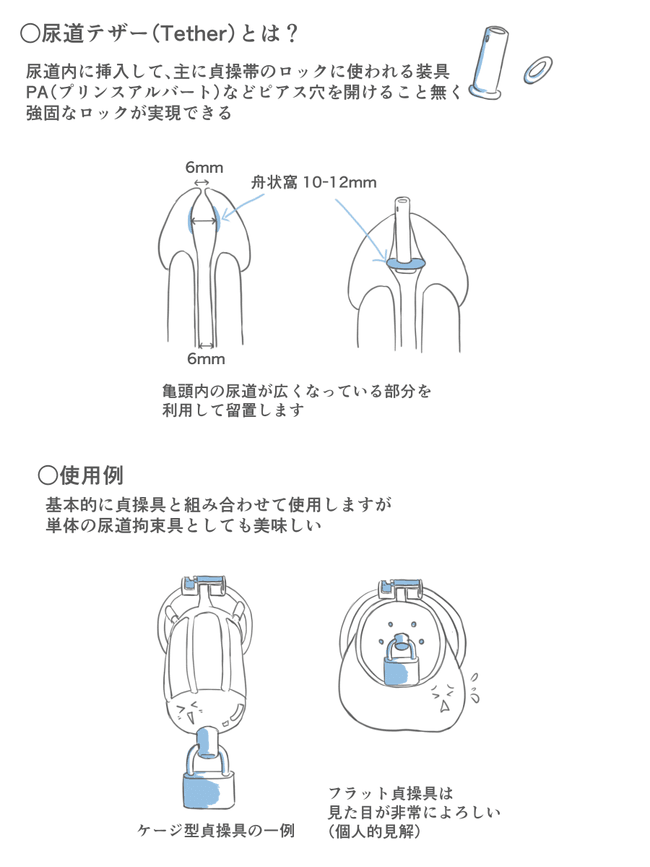 尿道テザーとは